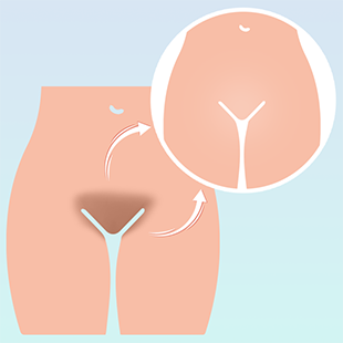 genital-beyazlatma-768x768